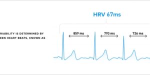 A graph illustrating heart rate variability (hrv) with peaks marked at 859 ms, 793 ms, and 726 ms, demonstrating the rr intervals between heartbeats that determine hrv in